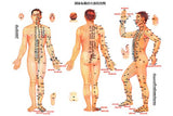 acupuncture Mini Poster 11inx17in poster