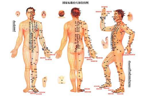 acupuncture poster tin Metal Print Wall Art